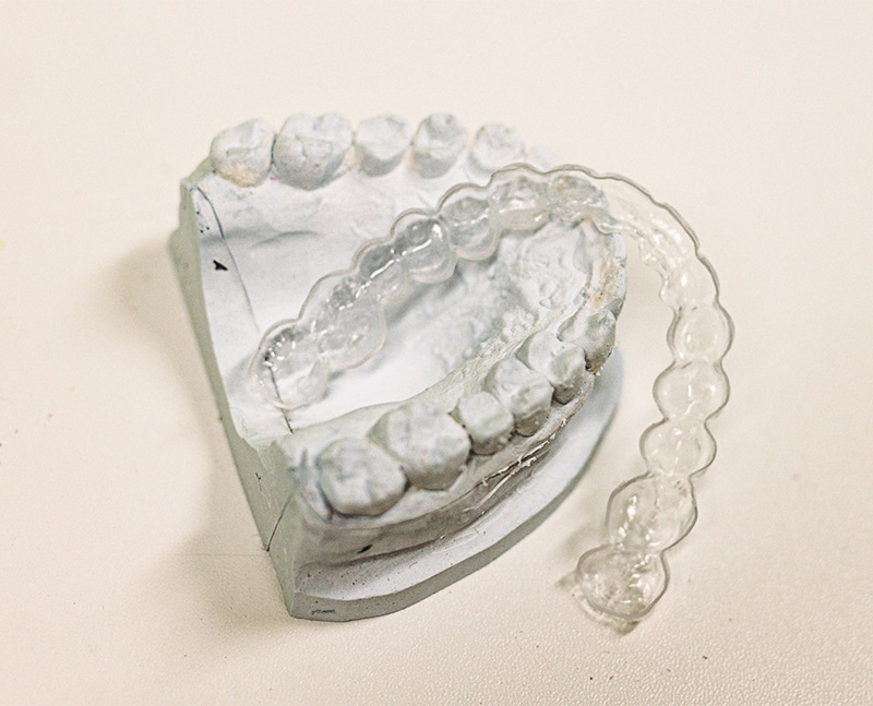 INVISALIGN - Schienentherapie